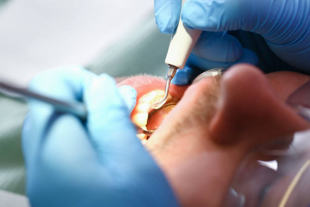 Best Cracked Tooth Emergency Dentist  in River Ridge, LA