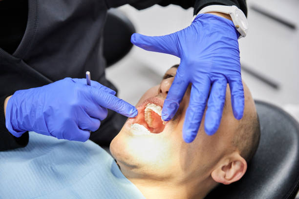 Best Dentist for Tooth Abscess  in River Ridge, LA